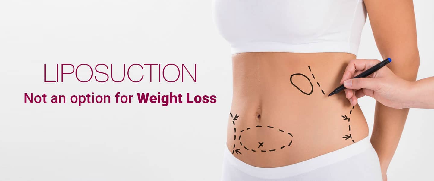 Read more about the article What is Liposuction Surgery & What to expect from Fat Removal Surgery?